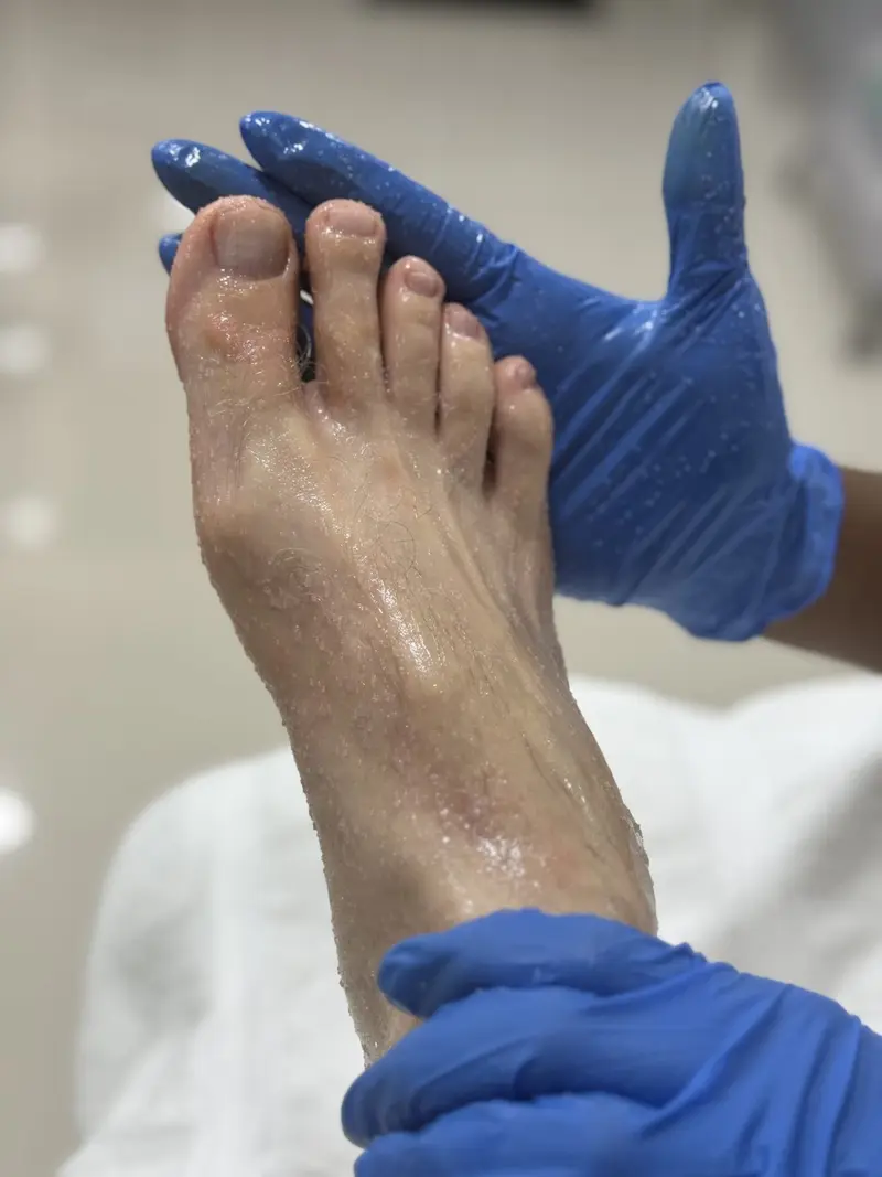 Pie con gel durante un tratamiento, con las manos enguantadas de la terapeuta