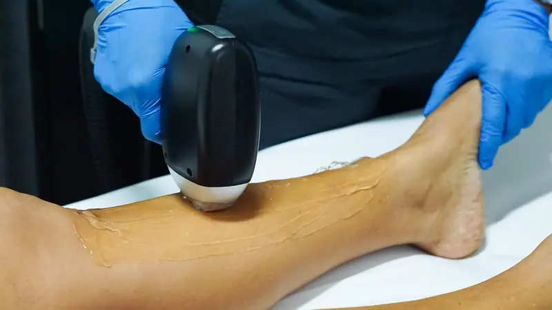 Aplicador de láser deslizándose sobre una pierna con gel